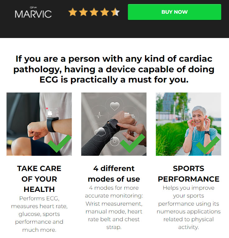 Marvic ECG Smartwatch Review